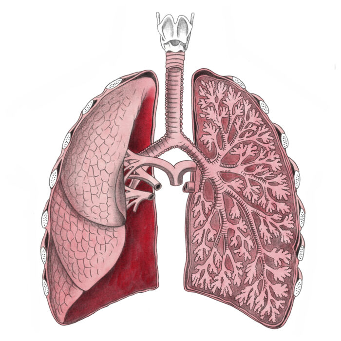 I de værste sygdomstilfælde ødelægger tuberkulose vævet i lungerne. Illustration: Sine Jensen